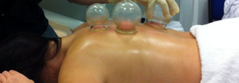 Cupping Therapy For A Month? It’s Dangerous!